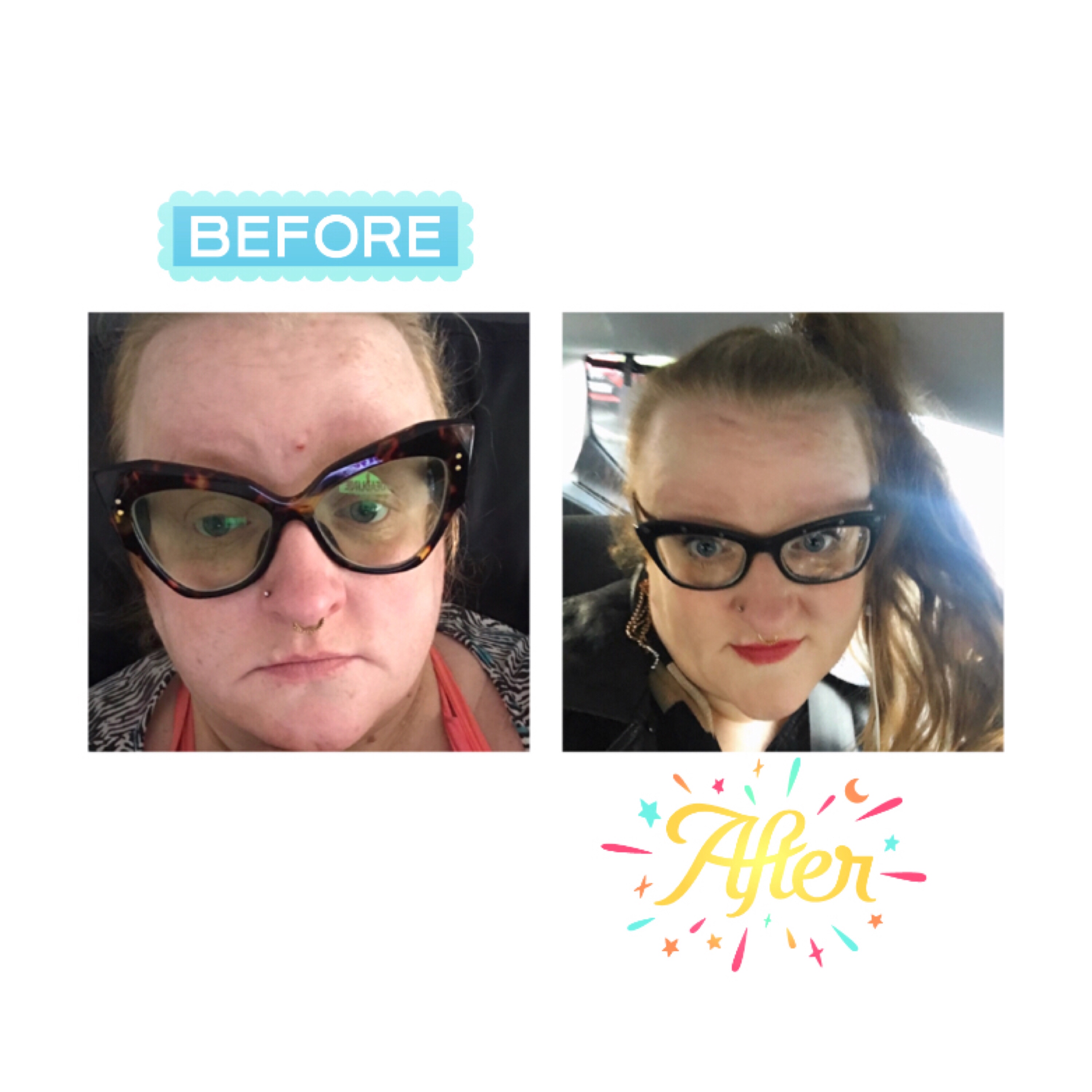 ly h Kerr, before & after