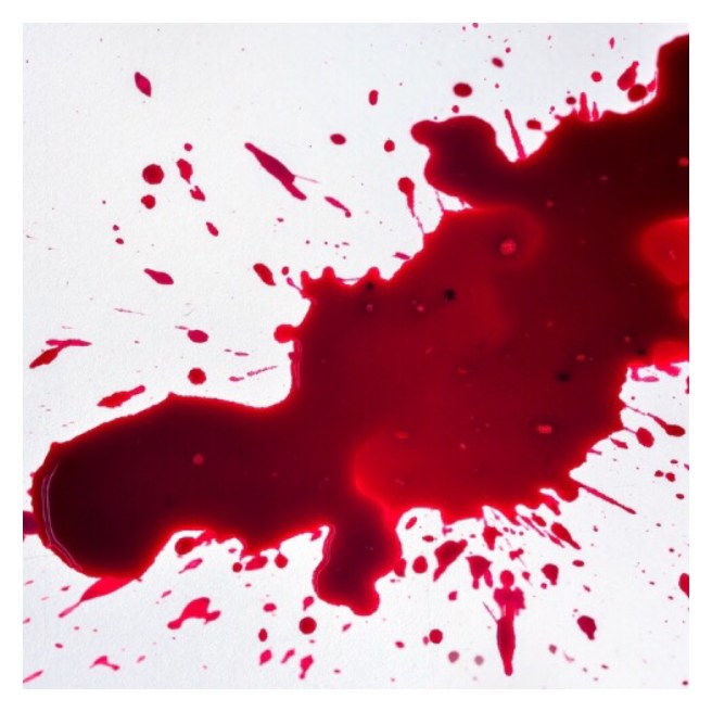 Blood splatter