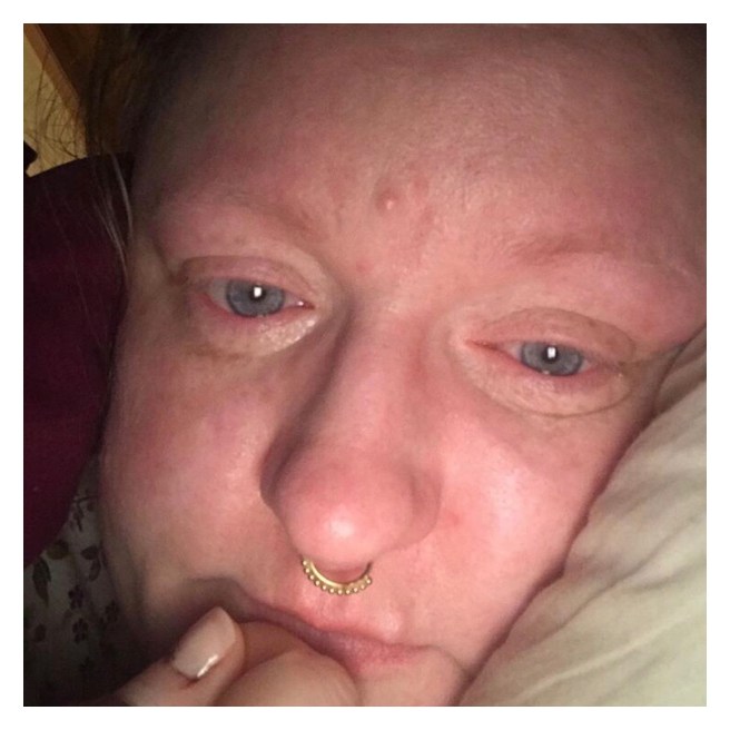 Woman in bed with teary eyes 