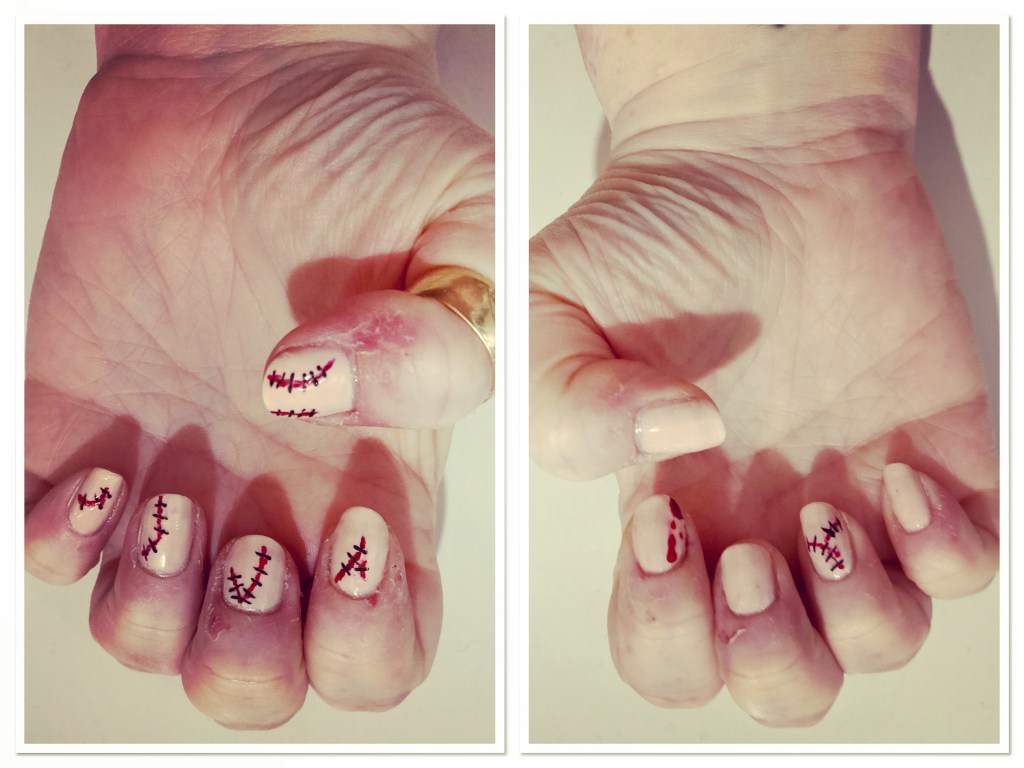 Pale white hands with stitched wound design manicure