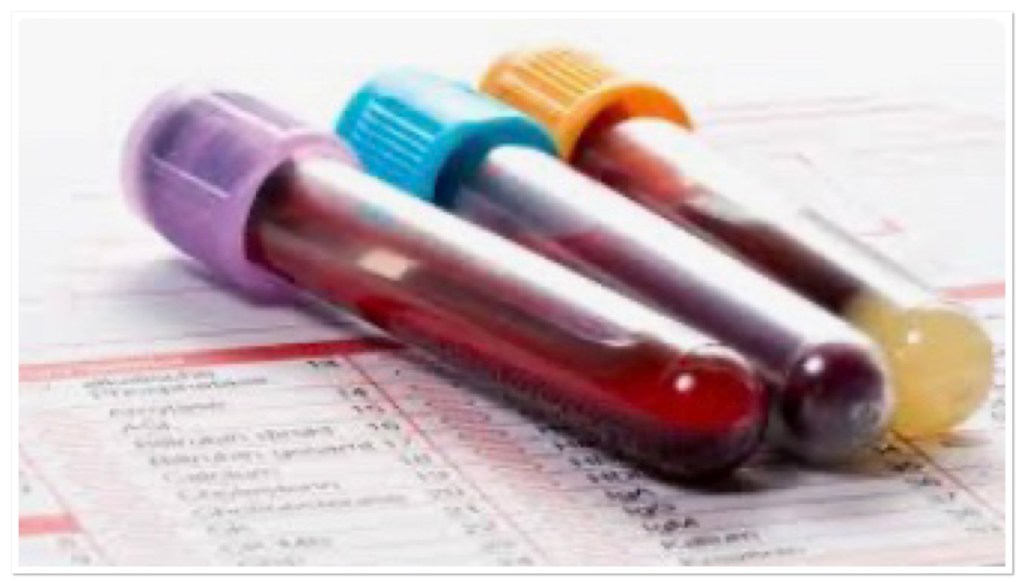 Three blood test bottles